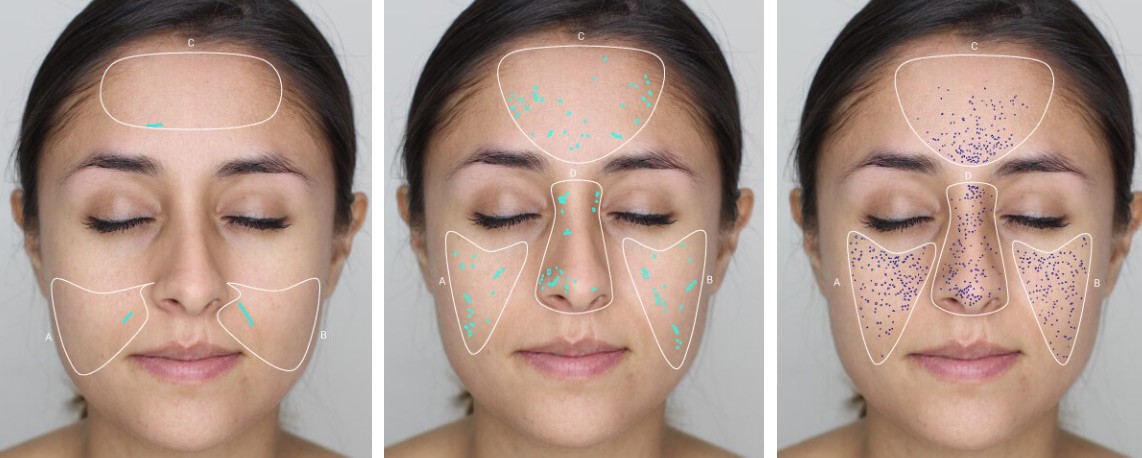 Le miroir analyse les problématiques de notre peau à corriger à l'aide d'une seule photo. himirror miroir intelligent soin peau meilleure routine produit creme rides cernes pores